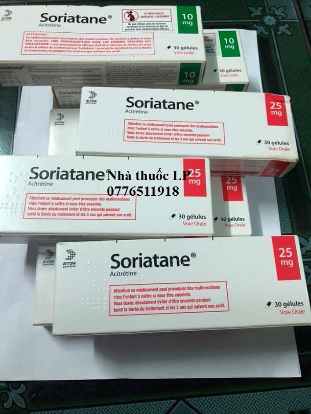 Thuốc Soriatane 25mg Acitretin điều trị bệnh vẫy nến (1)